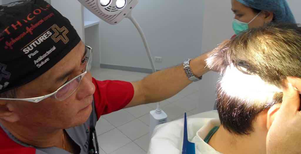 permanent hair transplant