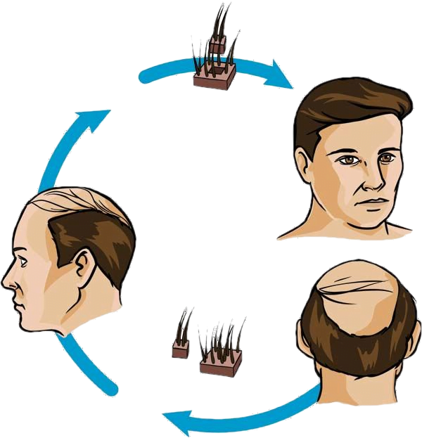 fue hair cycle