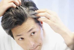 hair transplant houston and sun damaged hair