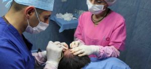 permanent procedure in hair transplant