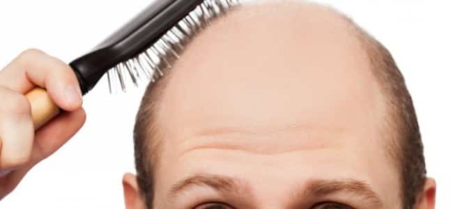 hair loss - MAXiM Hair Restoration