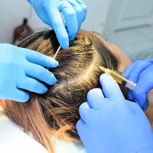 hair transplant method